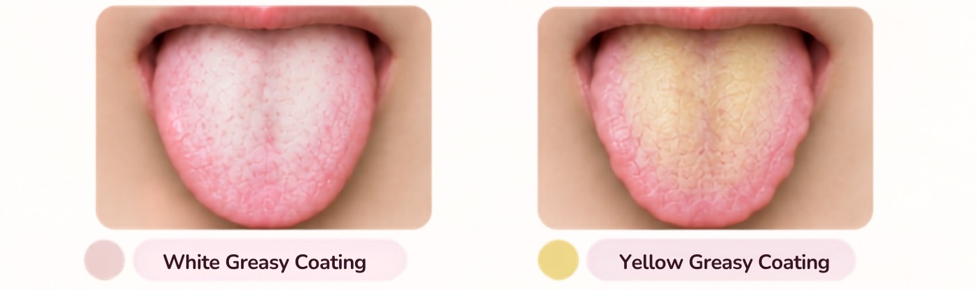 Two tongue photos side by side: white greasy coating and yellow greasy coating