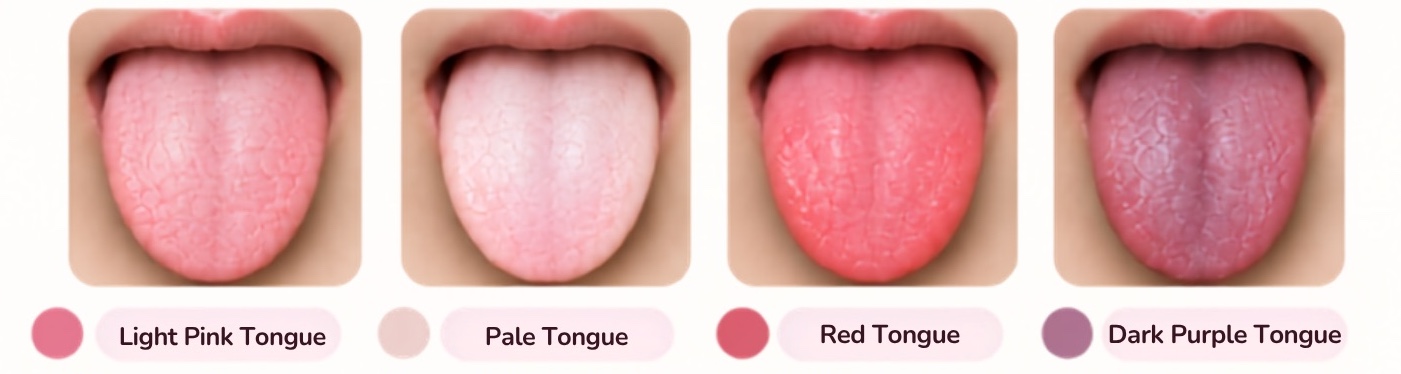 Four tongue photos side by side: light pink, pale, red and dark purple tongue colour